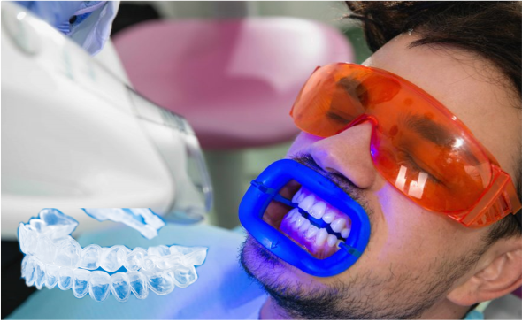 blanqueamiento-dental-combinado-fundas